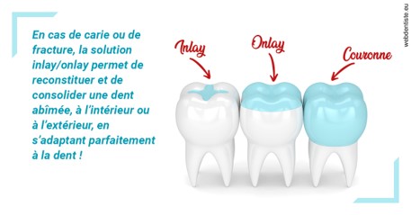 https://selarl-haussmann-setbon.chirurgiens-dentistes.fr/L'INLAY ou l'ONLAY