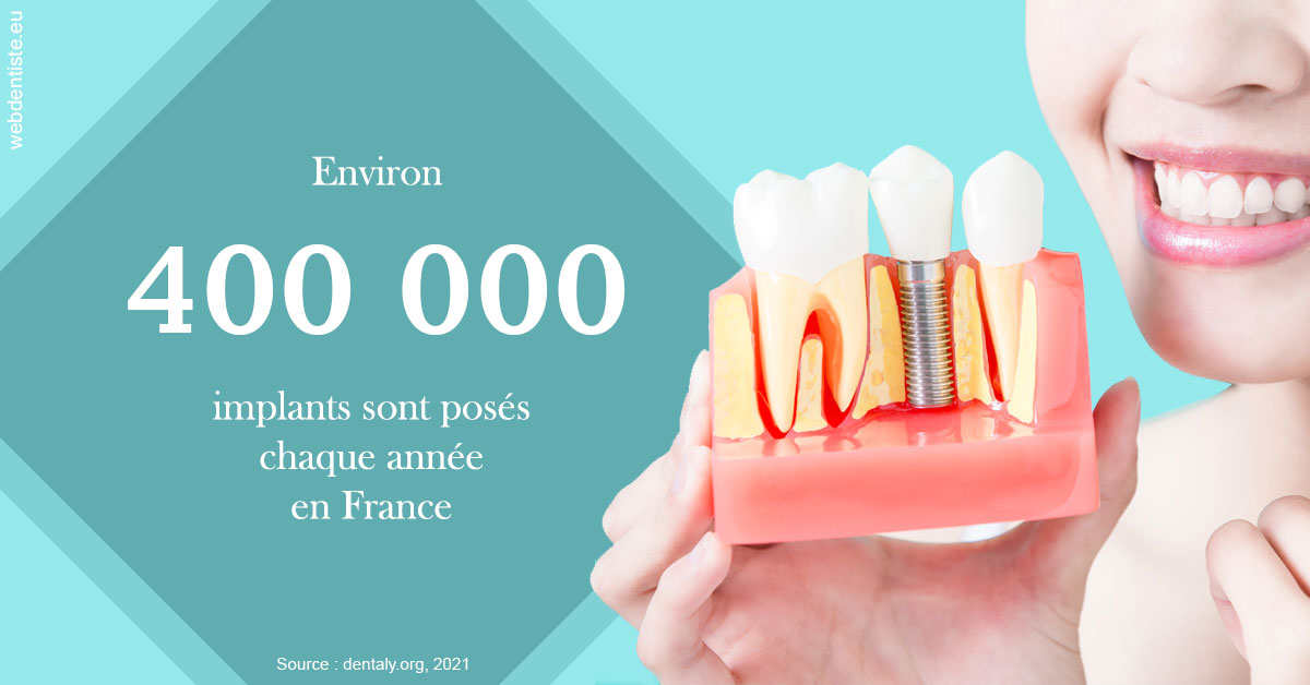 https://selarl-haussmann-setbon.chirurgiens-dentistes.fr/Pose d'implants en France 2
